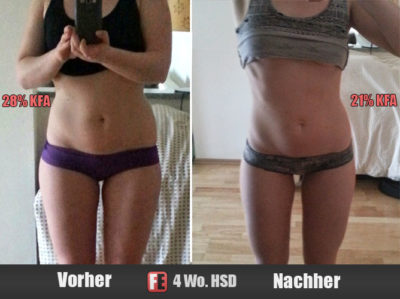 Sarah Vorher-Nachher mit HSD